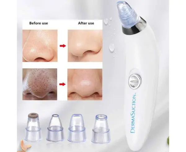 Blackhead Removal Machine-derma Sk products