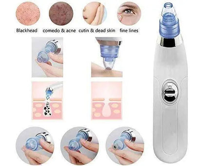 Blackhead Removal Machine-derma Sk products